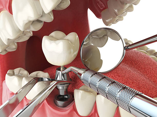 Best Emergency Treatment for Oral Infections in Fairview, UT